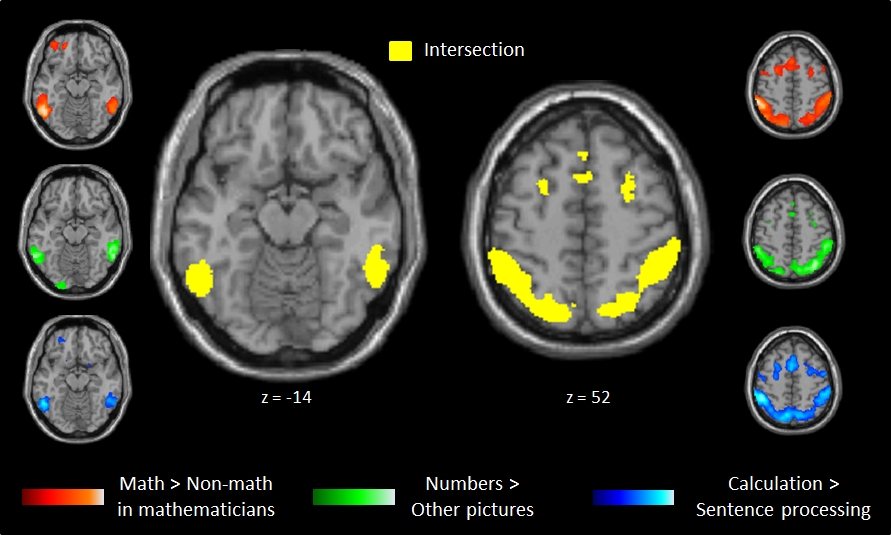 Réseaux cérébraux des mathématiques chez les mathématiciens professionnels / Brain networks for mathematics in professional mathematicians